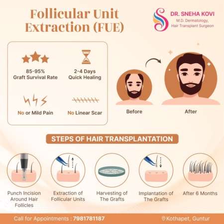 Benefits and procedure of FUE hair transplantation