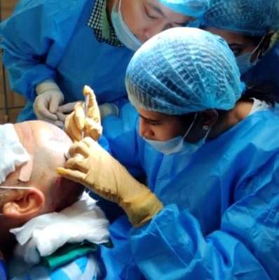 Dr. Sneha Kovi performing hair transplantation in guntur