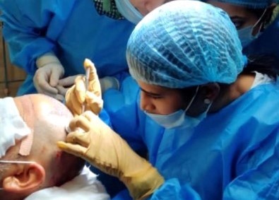 Dr. Sneha Kovi performing hair transplant surgery