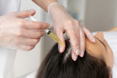 A woman undergoing PRP Hair Treatment