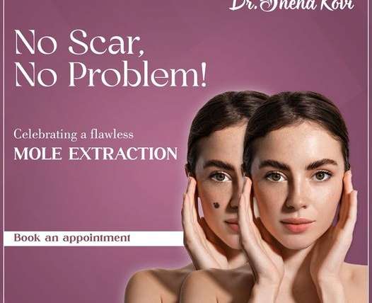 Effective Methods to Eliminate Dark Scars: 5 Skincare Treatments Recommended by Dermatologists
