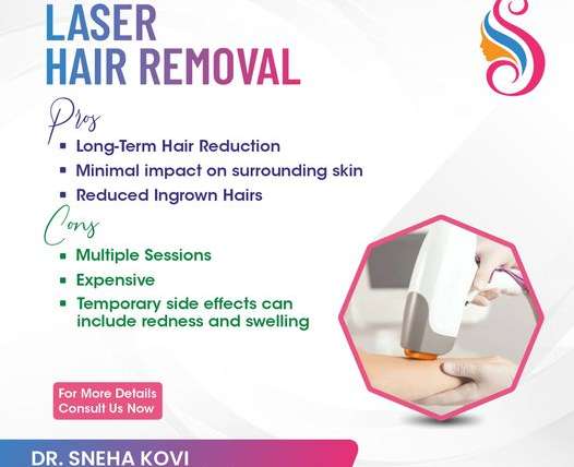 The Ultimate Guide to Laser Hair Removal: What You Need to Know