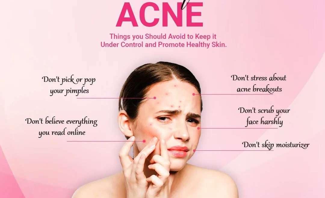 Top Don’ts for Acne: Keeping Your Skin Clear and Healthy