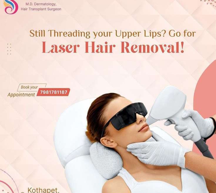 From Threading to Laser: The Modern Approach to Upper Lip Hair Removal